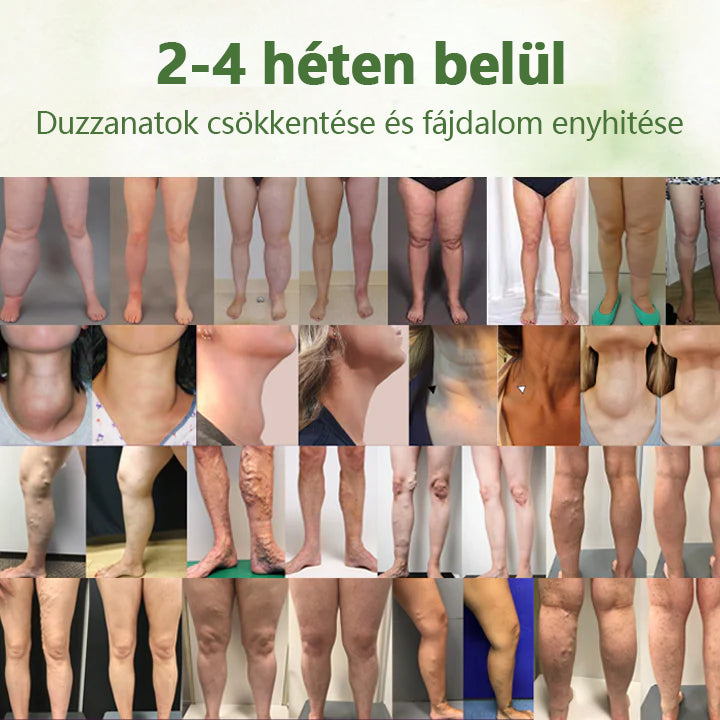 Cvreoz® Gyógynövényes nyirokrendszeri méregtelenítő krém ⭐️