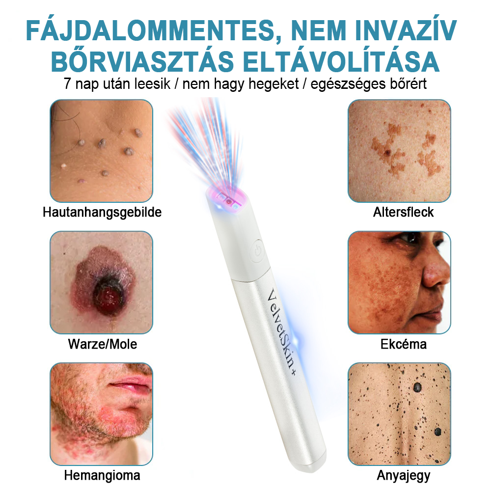 ✨ Bikenda®  – Laserowy Długopis CO₂ do Usuwania 🟤 Znamion, 🦠 Brodawek, 🔘 Przebarwień i Innych Niedoskonałości Skóry）☪️