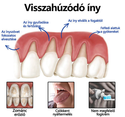 🤍🦷 Furzero® méhméreg kezelőpor szájon át történő alkalmazásra (🇩🇪 BZÄK által jóváhagyott) 🌿