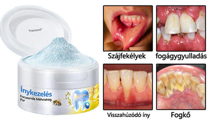 🤍🦷 Furzero® méhméreg kezelőpor szájon át történő alkalmazásra (🇩🇪 BZÄK által jóváhagyott) 🌿
