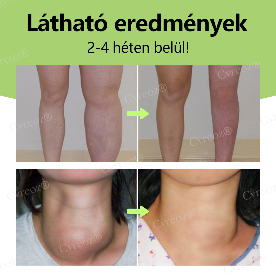 Cvreoz® Gyógynövényes nyirokrendszeri méregtelenítő krém  🌻