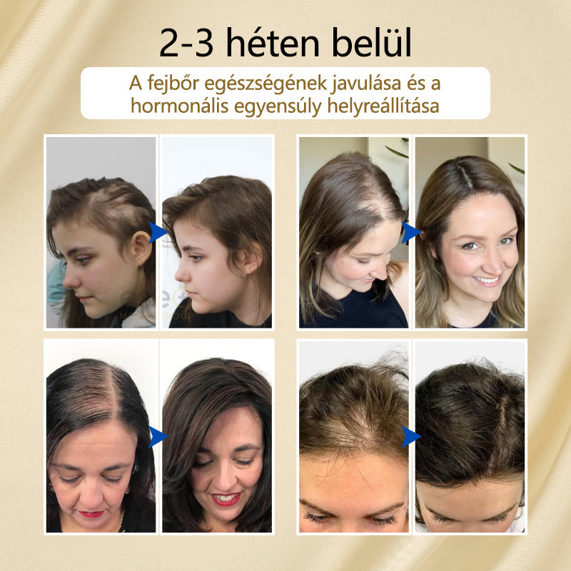 Timilk® VitaStrand Biotin hajnövekedést elősegítő spray✅ Sűrű, fényes haj néhány hét alatt  📦
