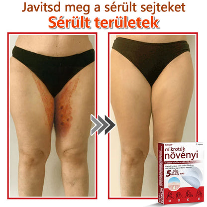 ✅KUBOZN® Mikrotűs Botanikus Bőrkinövés Eltávolító Tapaszok | Magyarországon készült  🛒