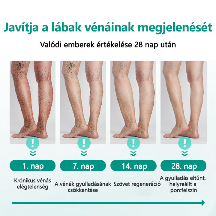 ✅✅Timilk® LegRenew Visszér Tapasz
