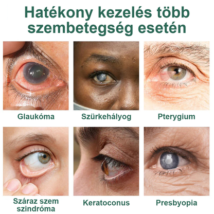 👩‍⚕️Ourlyard® Nano szemcsepp szérum ✅FDA által jóváhagyott (Alkalmas presbyopia, száraz szem szindróma, glaukóma és szürkehályog esetén) 🌿
