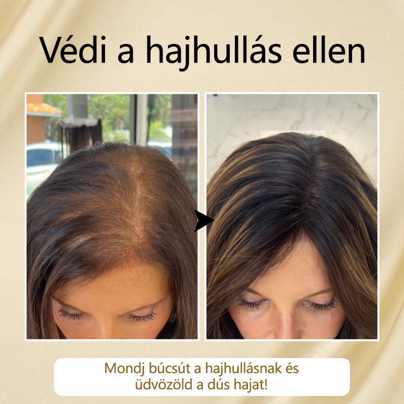 Timilk® VitaStrand Biotin hajnövekedést elősegítő spray✅ Sűrű, fényes haj néhány hét alatt  📦