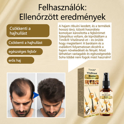 Timilk® VitaStrand Biotin hajnövekedést elősegítő spray✅ Sűrű, fényes haj néhány hét alatt  📦