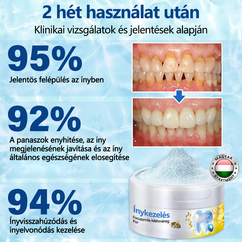 🤍🦷 Furzero® méhméreg kezelőpor szájon át történő alkalmazásra (🇩🇪 BZÄK által jóváhagyott) 🌿