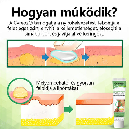 Cvreoz® Gyógynövényes nyirokrendszeri méregtelenítő krém  🌻