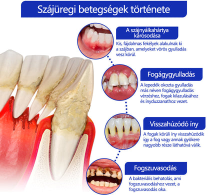🤍🦷 Furzero® méhméreg kezelőpor szájon át történő alkalmazásra (🇩🇪 BZÄK által jóváhagyott) 🌿