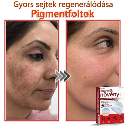 ✅KUBOZN® Mikrotűs Botanikus Bőrkinövés Eltávolító Tapaszok | Magyarországon készült  🛒